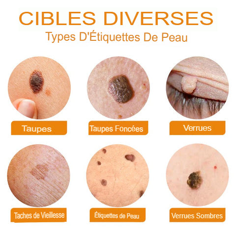 CREME AU VENIN D'ABEILLE CONTRE LES DEMANGEAISONS