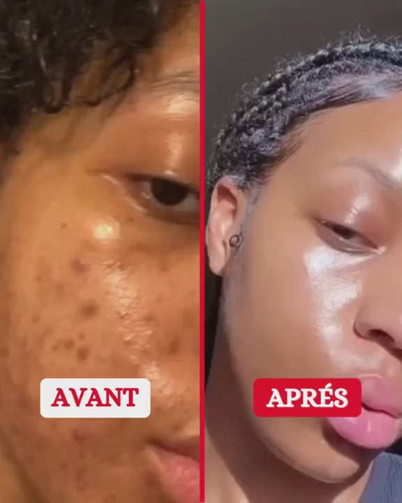 🍊GEL EXFOLIANT & ECLAIRCISSANT A BASE D'ORANGE🌞🍊