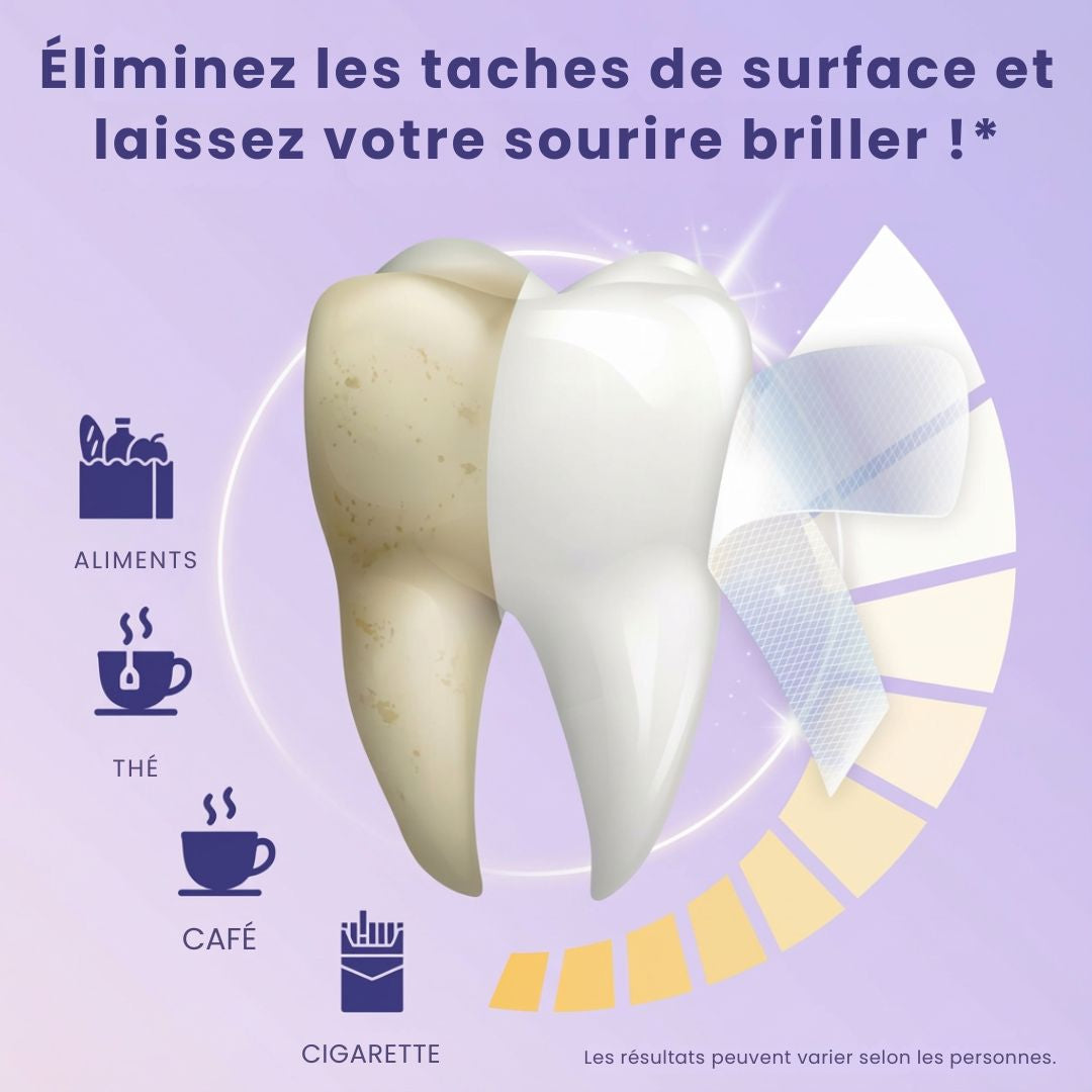 🦷BANDES POUR BLANCHIR LES DENTS JAUNES EN 30 MINUTES⏱️