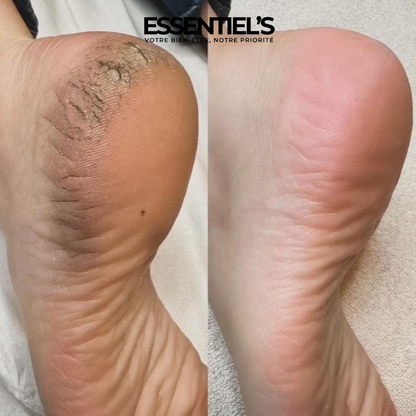 SOIN DE PIED - MASQUE POUR RETROUVER VOS PIEDS DE BÉBÉ EN 4 JOURS