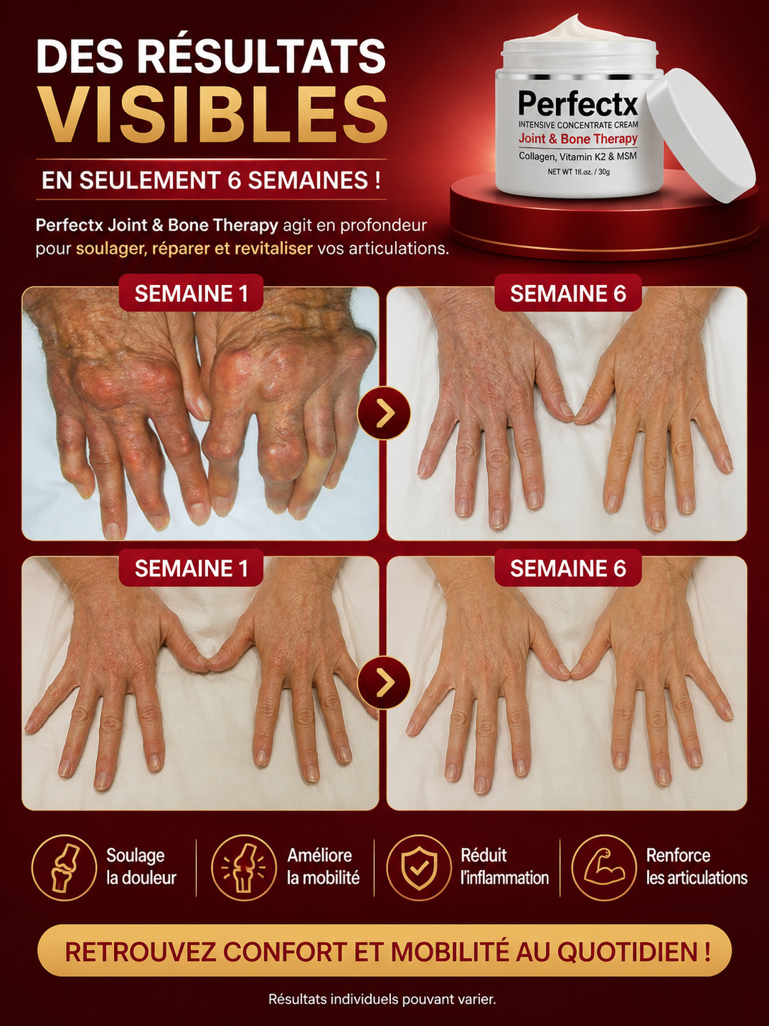 Crème Anti-Douleur Articulaire  👉 – Soulagement Rapide des Douleurs & Dites adieu aux douleurs articulaires en quelques minutes