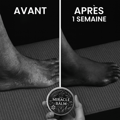 Miracle Balm — Vue 3