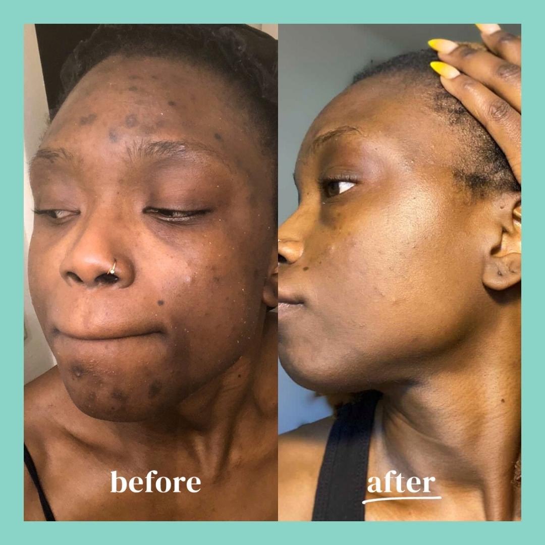 🍊GEL EXFOLIANT & ECLAIRCISSANT A BASE D'ORANGE🌞🍊