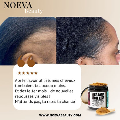 HUILE MIRACLE DE BATANA™  POUR LA POUSSE ET LA REPOUSSE DE VOS CHEVEUX