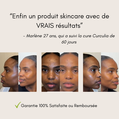 APPAREIL ÉPURATEUR DE VISAGE ✨💧 – ÉLIMINE L’ACNÉ, L’EXCÈS DE SÉBUM & LES GRAISSES 😍