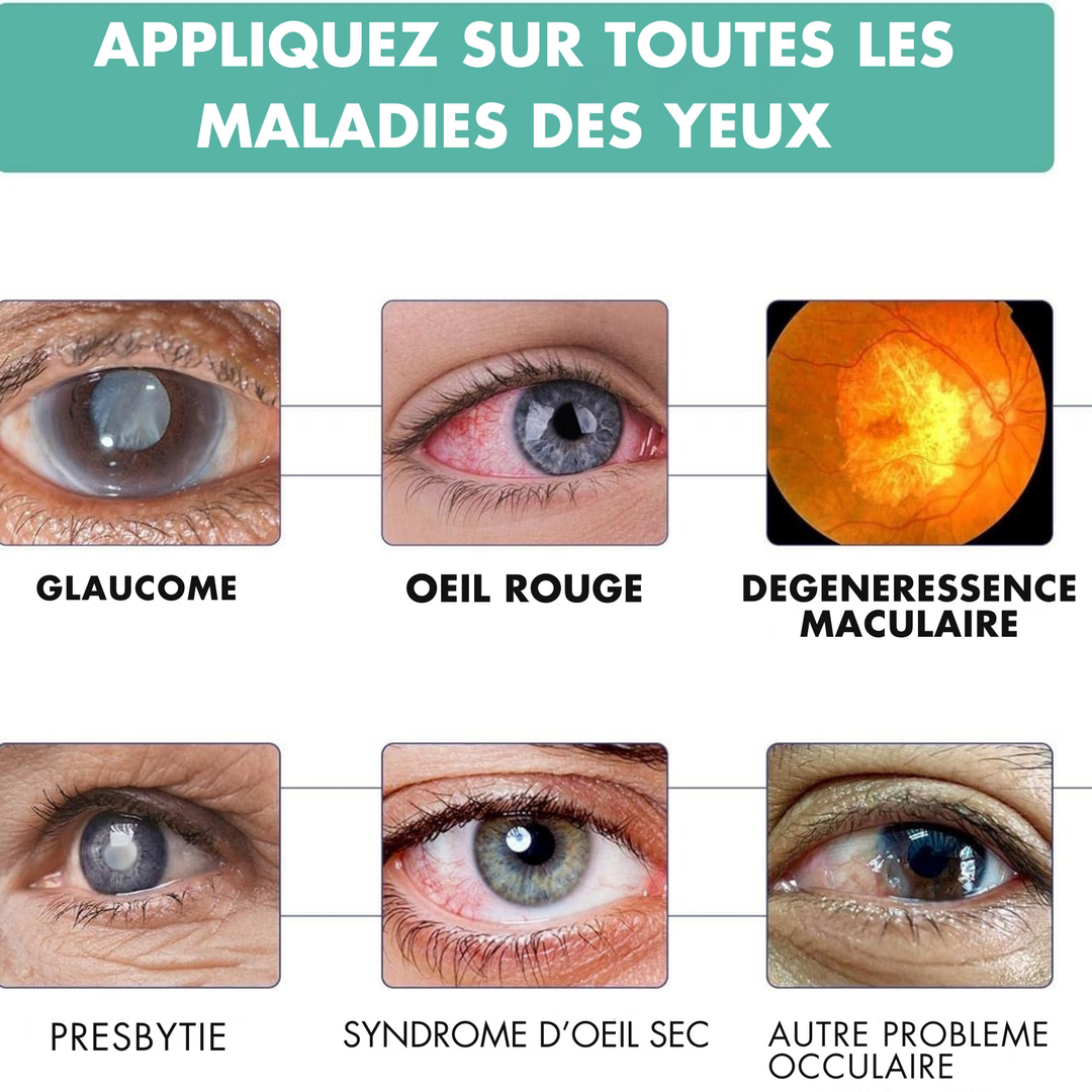 Vision Pro – Fatigue Oculaire, Tensions, Yeux Secs, Yeux Lourds & Stress Visuel des Écrans