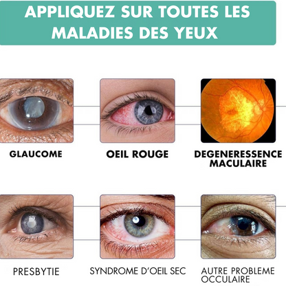 Vision Pro – Fatigue Oculaire, Tensions, Yeux Secs, Yeux Lourds & Stress Visuel des Écrans