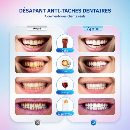 🦷DENTIFRICE BLANCHISSANT AU NIACINAMIDE 100% APPROUVÉ✅