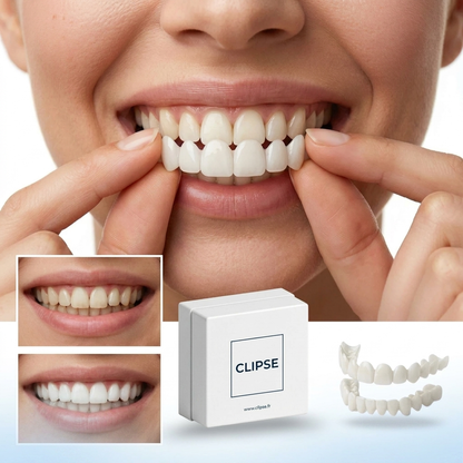 Facettes Dentaires Clipse — Vue 2